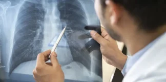 Tabagismo é maior entre jovens de 16 a 24 anos, alerta pesquisa