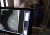 Plano de saúde terá que cobrir mamografia digital para todas as idades