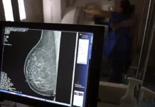 Plano de saúde terá que cobrir mamografia digital para todas as idades